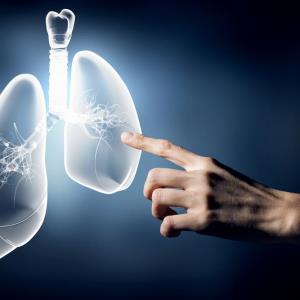 Sotorasib demonstrates durable efficacy in KRASG12C-mutated NSCLC