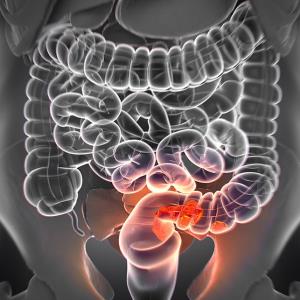 Sotorasib-panitumumab combo shows positive OS trend in mCRC