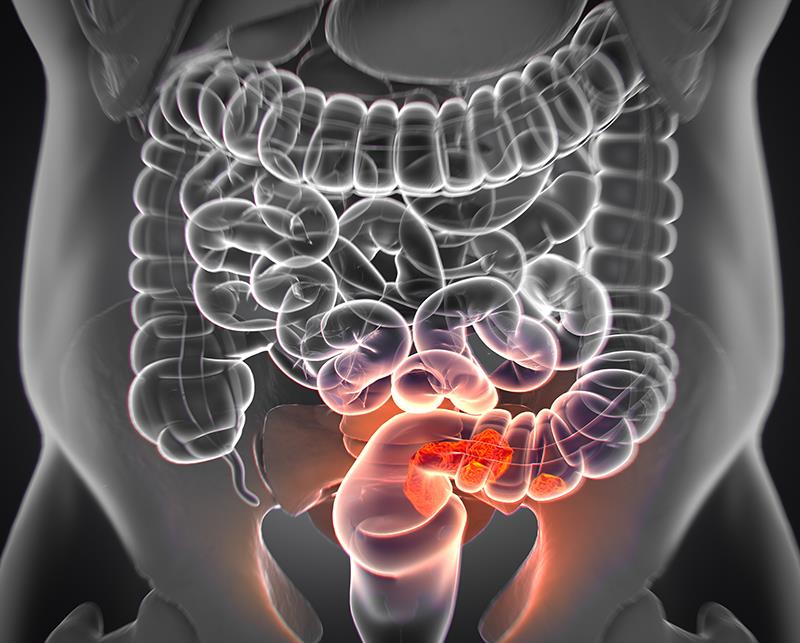 Sotorasib-panitumumab combo shows positive OS trend in mCRC