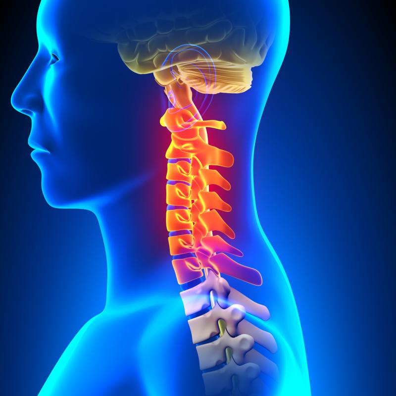 The part of the spine enclosed in the cervical vertebrae is a sensitive region that can cause paralysis when subjected to tra