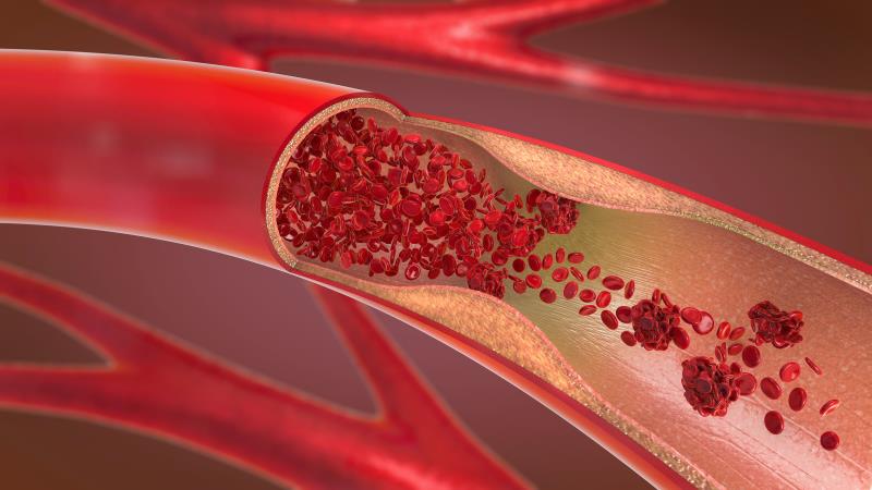 Starting oestradiol therapy soon after menopause may be good for heart health