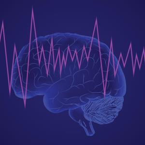 Reteplase compares favourably with alteplase for acute ischaemic stroke