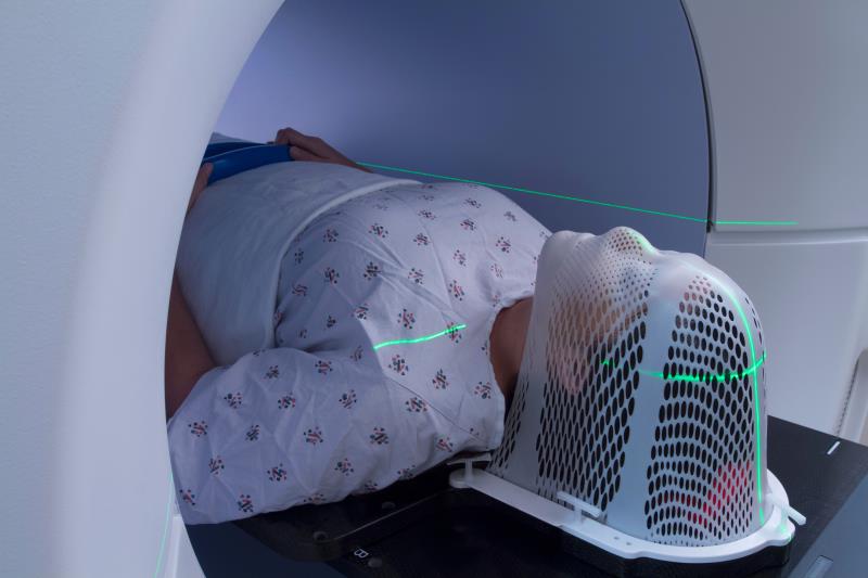 Radiotherapy, squamous cell carcinoma predict positive response to therapy in esophageal cancer