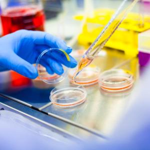 Multiple myeloma patients show excellent response to stem cell treatment