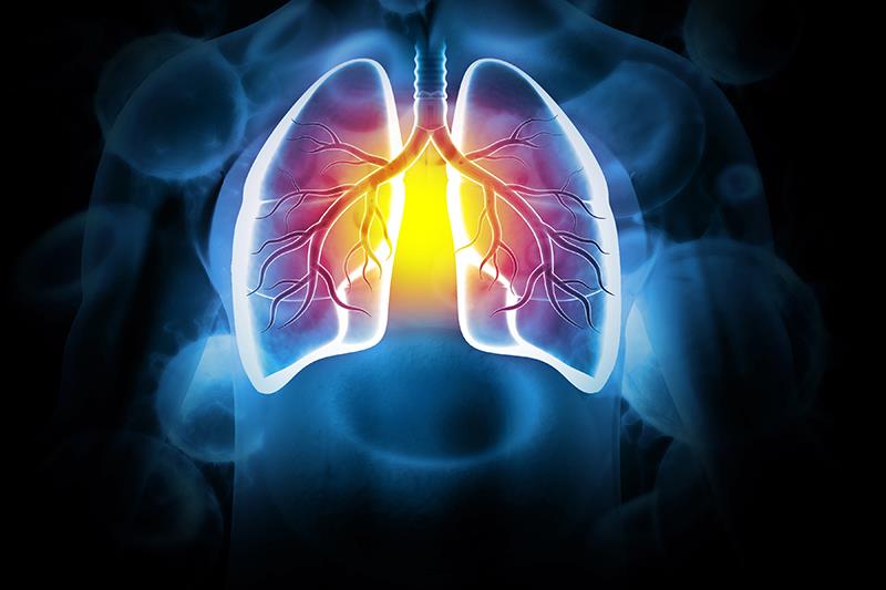 Steroid use may increase mortality in acute exacerbation of fibrotic interstitial lung disease