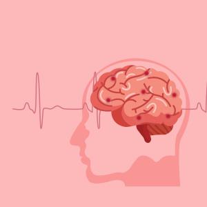 Stroke tied to higher death risk in hospitalized COVID-19 patients