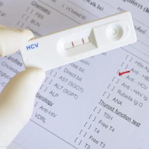 From 20 to 5 min: Shortened read time of rapid HCV antibody test just as sensitive