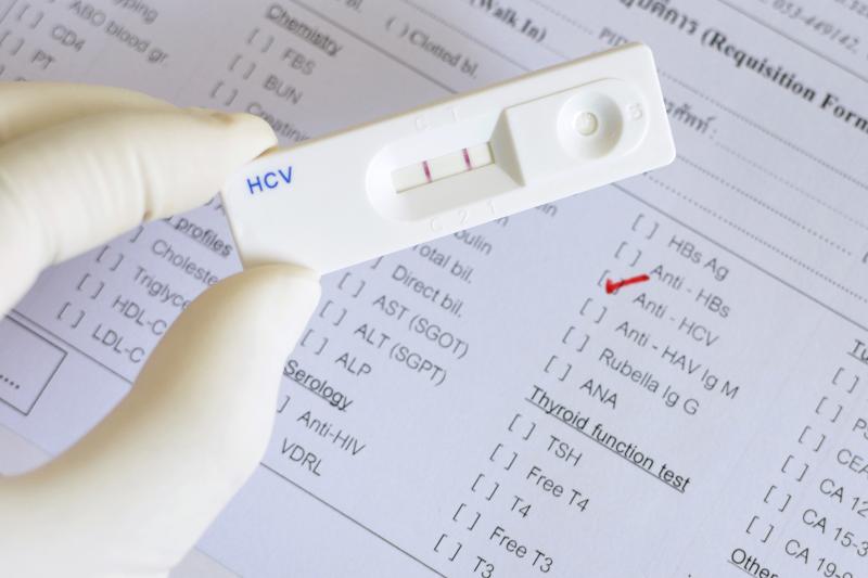 From 20 to 5 min: Shortened read time of rapid HCV antibody test just as sensitive