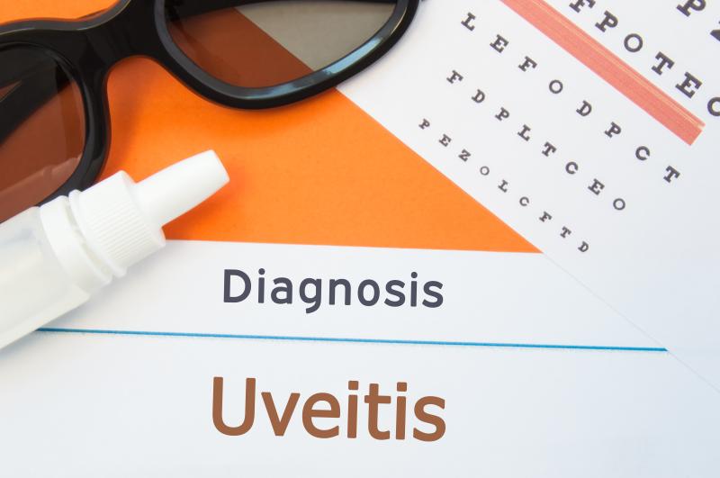 Female hormonal therapy may promote noninfectious uveitis