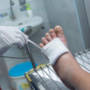 Timely wound management improves lives of patients with DFU