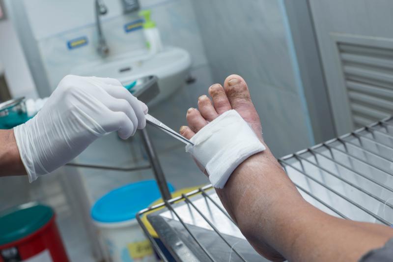 Timely wound management improves lives of patients with DFU
