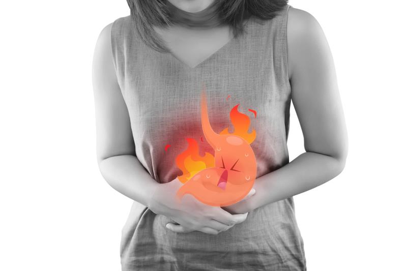 Surgery a potential treatment for GERD-related heartburn