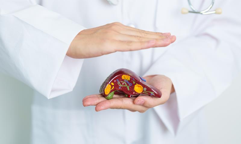 NASH cirrhosis tied to better survival than other aetiologies