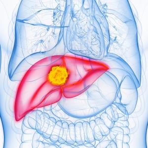 TACE + apatinib: A potential new strategy for intermediate/advanced HCC?