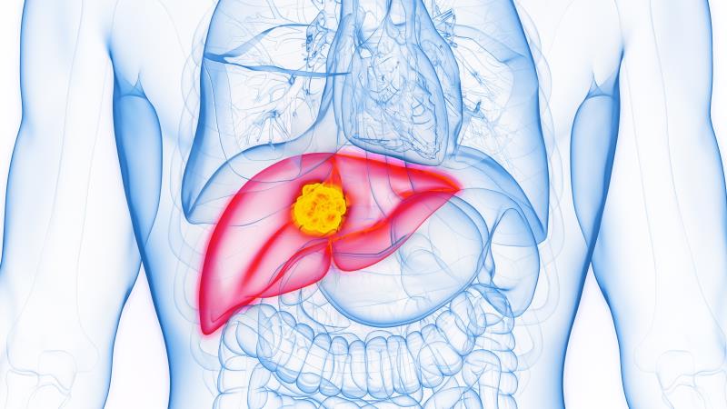 TACE + apatinib: A potential new strategy for intermediate/advanced HCC?