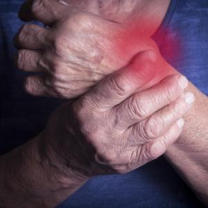 Pain, self-reported swollen joints tied to flares in rheumatoid arthritis