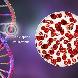 Targeting PV source with ropeginterferon alfa-2b revolutionizes treatment
