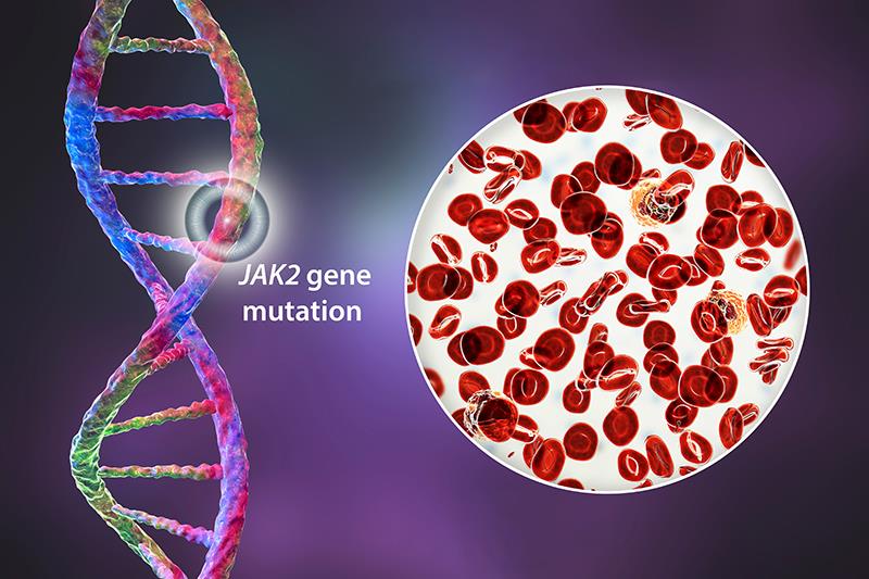 Targeting PV source with ropeginterferon alfa-2b revolutionizes treatment