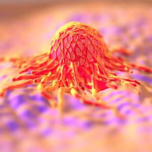 TaTME-DCAA feasible for low rectal cancer