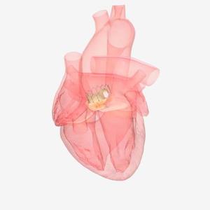TAVI superior to surgery in women with aortic stenosis