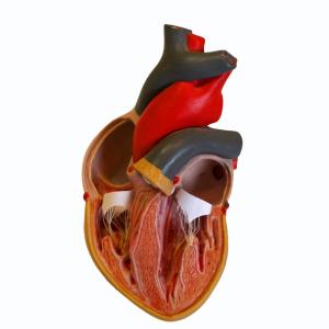 TAVR effective in both bicuspid and tricuspid valves