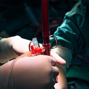 Transcatheter better than surgical aortic valve replacement for patients with aortic stenosis