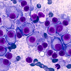 Teclistamab demonstrates clinical activity for R/R MM