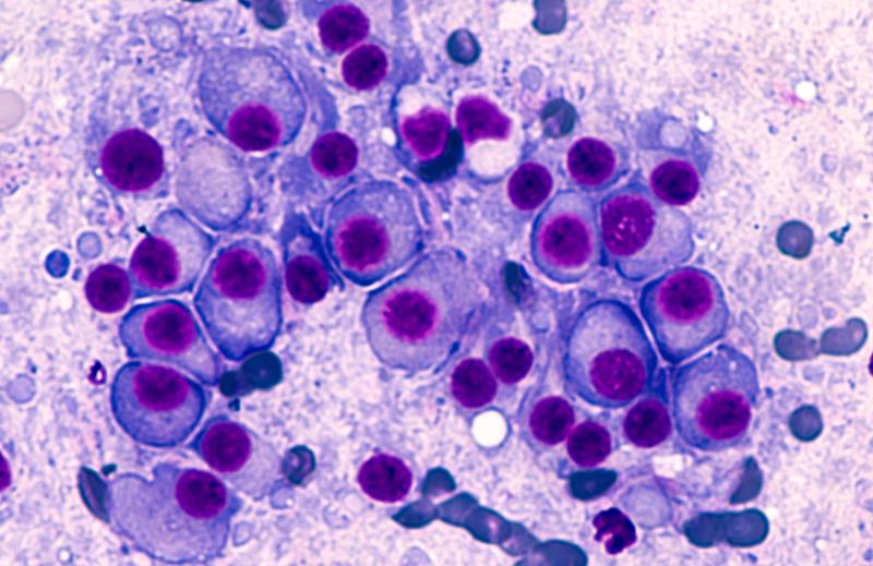 Teclistamab demonstrates clinical activity for R/R MM