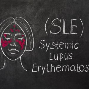 Telitacicept tied to higher SRI-4 response in SLE patients