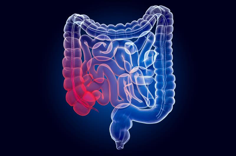 Tenapanor improves symptoms in patients with IBS-C