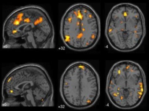 The fMRI brain scans from UBC Mind Wandering Study. Photo credit: Kalina Christoff/Science Daily