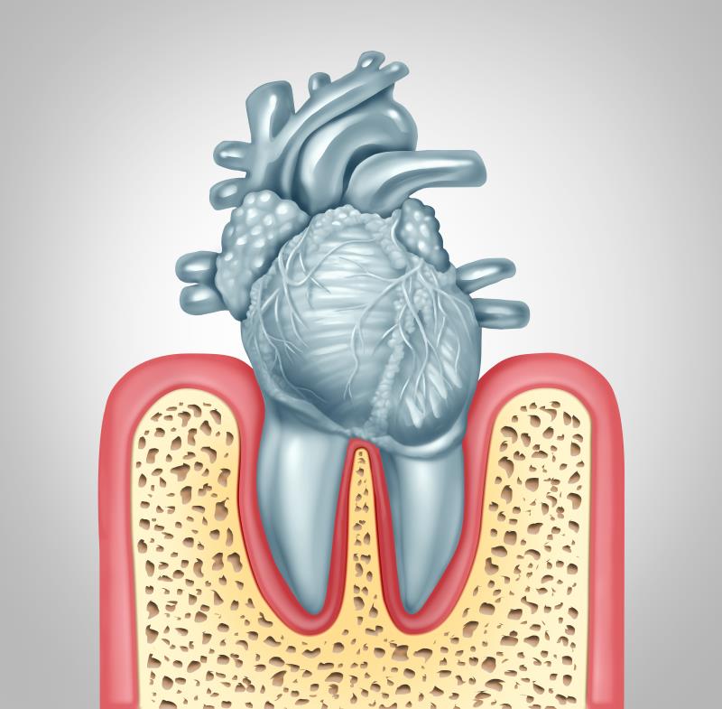 The mouth: A gateway to heart disease?