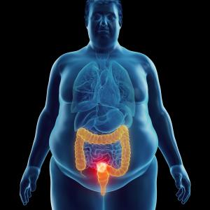 Does obesity reduce risk of death in cancer patients?