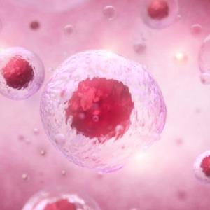 The role of ropeginterferon alfa-2b in the management of polycythaemia vera in SG
