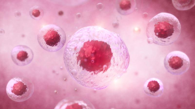 The role of ropeginterferon alfa-2b in the management of polycythaemia vera in SG