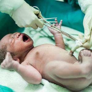 Newborn screening detects late-onset Pompe disease, allows for early intervention