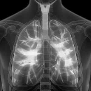 Lung ultrasound helps rule out ILD in patients with RA