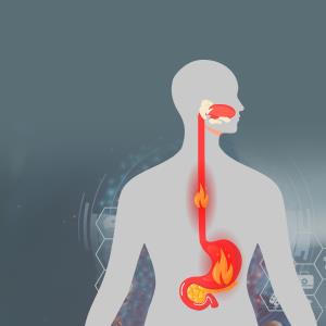 Peroral endoscopic myotomy safe, effective for achalasia with sigmoid oesophagus