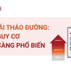 [Infographic] Tiền đái tháo đường: Mối nguy cơ ngày càng phổ biến