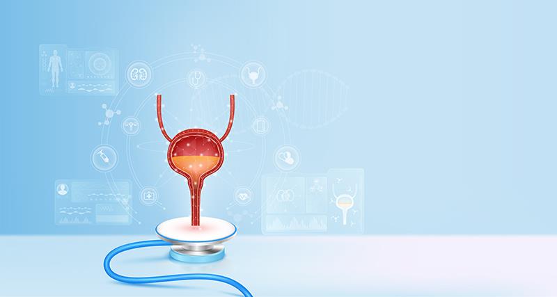 Tislelizumab a new Tx alternative for very high-risk bladder cancer?