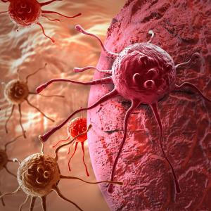 Circulating tumour DNA predicts survival, helps guide therapy in colorectal cancer