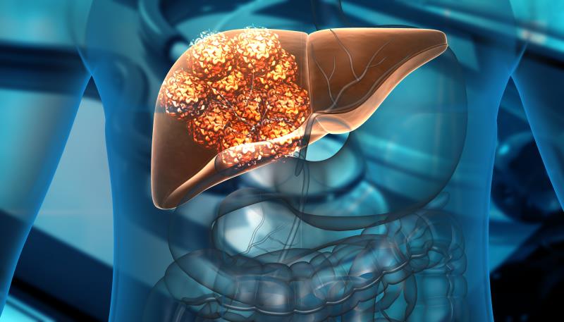 RATIONALE-208 subanalyses boost tislelizumab potential for HCC