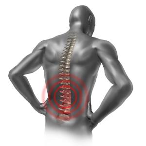 Ixekizumab a viable long-term treatment option for axial spondyloarthritis