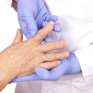 TNFi use in RA tied to reduced VTE risk