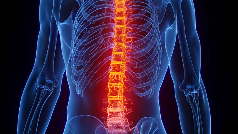 Tofacitinib safe, efficacious in ankylosing spondylitis regardless of baseline CRP