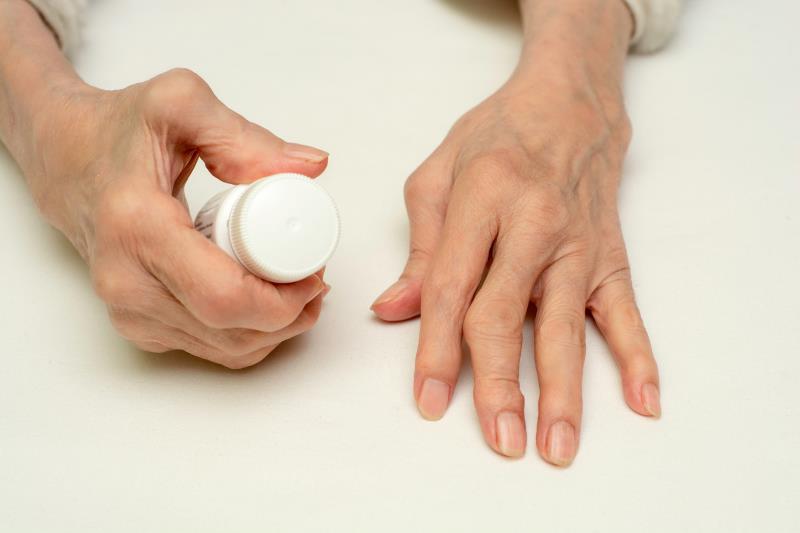 Tofacitinib shows good retention rates in PsA patients