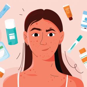 Add-on desloratadine helps reduce acne itching, improve treatment satisfaction