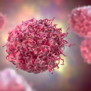 Toripalimab plus chemo improves survival in NSCLC