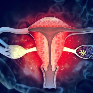 Intraperitoneal paclitaxel-cisplatin therapy does not prolong survival in stage III ovarian cancer