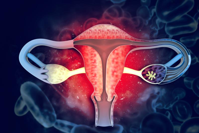 Intraperitoneal paclitaxel-cisplatin therapy does not prolong survival in stage III ovarian cancer